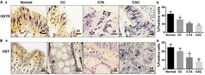 Oxytocin Inhibition of Metastatic Colorectal Cancer by Suppressing the Expression of Fibroblast Activation Protein-α